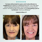 Fit Full Functional Dentures Make You More Confident