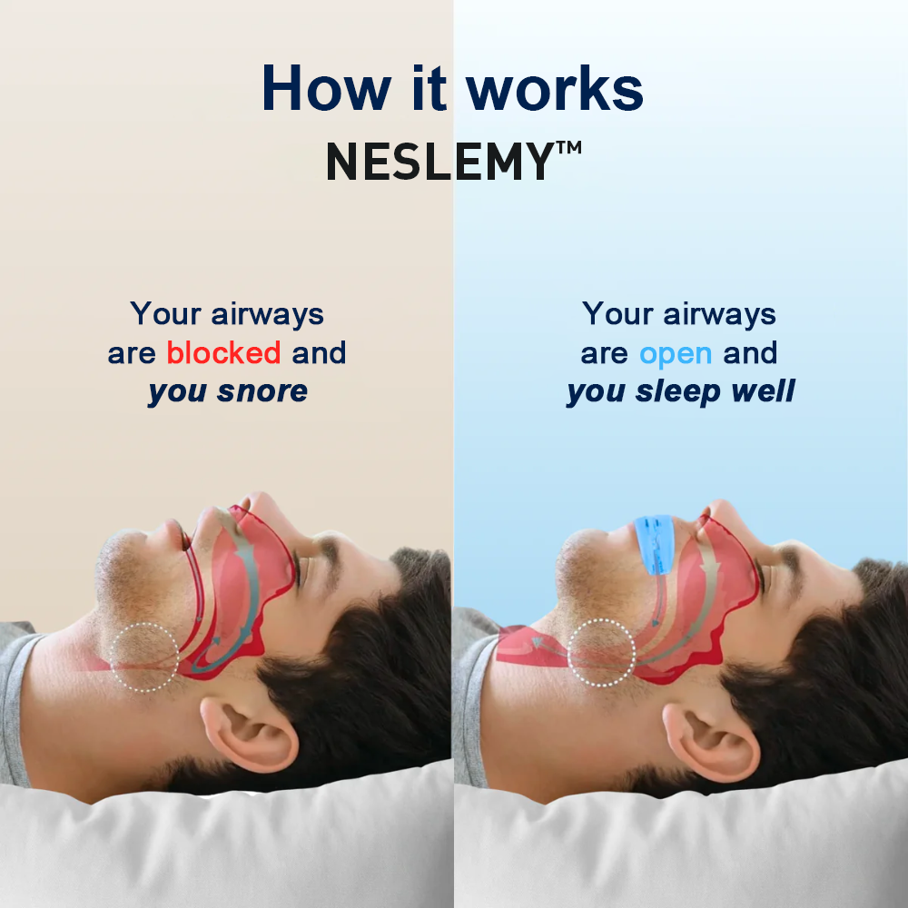 Professional Intelligent Anti-snoring Device